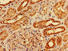Immunohistochemistry of paraffin-embedded human kidney tissue using AGPAT3 Antibody at dilution of 1:100