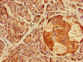 Immunohistochemistry of paraffin-embedded human pancreatic tissue using AGPAT3 Antibody at dilution of 1:100