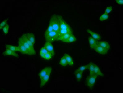 Immunofluorescence staining of HepG2 cells with LANCL2 Antibody at 1:100, counter-stained with DAPI. The cells were fixed in 4% formaldehyde, permeabilized using 0.2% Triton X-100 and blocked in 10% normal Goat Serum. The cells were then incubated with the antibody overnight at 4°C. The secondary antibody was Alexa Fluor 488-congugated AffiniPure Goat Anti-Rabbit IgG(H+L).