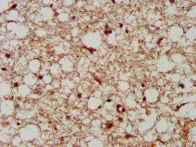 IHC image of LANCL2 Antibody diluted at 1:300 and staining in paraffin-embedded human brain tissue performed on a Leica BondTM system. After dewaxing and hydration, antigen retrieval was mediated by high pressure in a citrate buffer (pH 6.0). Section was blocked with 10% normal goat serum 30min at RT. Then primary antibody (1% BSA) was incubated at 4°C overnight. The primary is detected by a biotinylated secondary antibody and visualized using an HRP conjugated SP system.