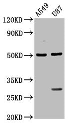 Western Blot  | Positive WB detected in: A549 whole cell lysate, U87 whole cell lysate  | All lanes: LANCL2 antibody at 3.5µg/ml  | Secondary  | Goat polyclonal to rabbit IgG at 1/50000 dilution  | Predicted band size: 51 kDa  | Observed band size: 51 kDa