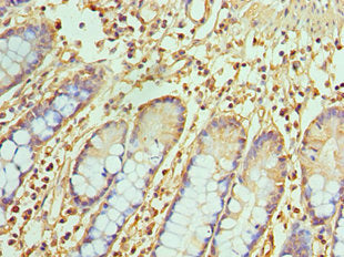 Immunohistochemistry of paraffin-embedded human small intestine tissue using TREX1 Antibody at dilution of 1:100Rabbit anti-Human TREX1 Polyclonal Antibody