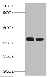 Western blot  | All lanes: Three-prime repair exonuclease 1 antibody at 3μg/ml  | Lane 1: Hela whole cell lysate  | Lane 2: HepG2 whole cell lysate  | Secondary  | Goat polyclonal to rabbit IgG at 1/10000 dilution  | Predicted band size: 39, 33, 34 kDa  | Observed band size: 39 kDaRabbit anti-Human TREX1 Polyclonal Antibody