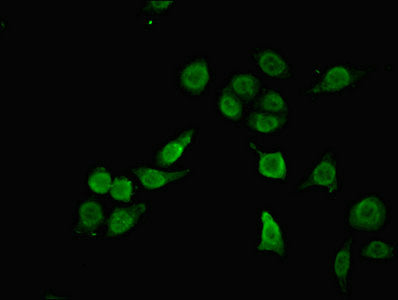 Immunofluorescent analysis of A549 cells using RBM12 Antibody at dilution of 1:100 and Alexa Fluor 488-congugated AffiniPure Goat Anti-Rabbit IgG(H+L)Rabbit anti-Human RBM12 Polyclonal Antibody