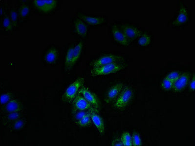 Immunofluorescent analysis of HepG2 cells using SPTLC3 Antibody at dilution of 1:100 and Alexa Fluor 488-congugated AffiniPure Goat Anti-Rabbit IgG(H+L)Rabbit anti-Human SPTLC3 Polyclonal Antibody