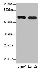 Western blot  | All lanes: SPTLC3 antibody at 0.2µg/ml  | Lane 1: Mouse kidney tissue  | Lane 2: U87 whole cell lysate  | Secondary  | Goat polyclonal to rabbit IgG at 1/10000 dilution  | Predicted band size: 63, 20 kDa  | Observed band size: 63 kDaRabbit anti-Human SPTLC3 Polyclonal Antibody