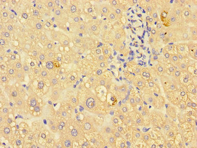 Immunohistochemistry of paraffin-embedded human liver tissue using ING3 Antibody at dilution of 1:100Rabbit anti-Human ING3 Polyclonal Antibody