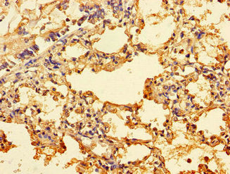 Immunohistochemistry of paraffin-embedded human lung tissue using ING3 Antibody at dilution of 1:100Rabbit anti-Human ING3 Polyclonal Antibody