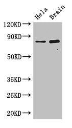 Western Blot | Positive WB detected in: Hela whole cell lysate, Mouse brain tissue | All lanes: DACH1 antibody at 2.8μg/ml | Secondary | Goat polyclonal to rabbit IgG at 1/50000 dilution | Predicted band size: 47, 12 kDa | Observed band size: 79 kDaRabbit anti-Human ING3 Polyclonal Antibody