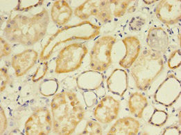 Immunohistochemistry of paraffin-embedded human kidney tissue using FLRT1 Antibody at dilution of 1:100Rabbit anti-Human FLRT1 Polyclonal Antibody