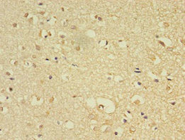 Immunohistochemistry of paraffin-embedded human brain tissue using FLRT1 Antibody at dilution of 1:100Rabbit anti-Human FLRT1 Polyclonal Antibody