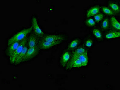 Immunofluorescent analysis of HepG2 cells using KIF17 Antibody at dilution of 1:100 and Alexa Fluor 488-congugated AffiniPure Goat Anti-Rabbit IgG(H+L)