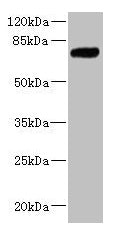 Western blot  | All lanes: KLHL13 antibody at 5.06µg/ml + Jurkat whole cell lysate  | Secondary  | Goat polyclonal to rabbit IgG at 1/10000 dilution  | Predicted band size: 74, 70, 73, 75 kDa  | Observed band size: 74 kDa