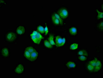 Immunofluorescence staining of MCF-7 cells with COPG2 Antibody at 1:133, counter-stained with DAPI. The cells were fixed in 4% formaldehyde, permeabilized using 0.2% Triton X-100 and blocked in 10% normal Goat Serum. The cells were then incubated with the antibody overnight at 4°C. The secondary antibody was Alexa Fluor 488-congugated AffiniPure Goat Anti-Rabbit IgG(H+L).Rabbit anti-Human COPG2 Polyclonal Antibody