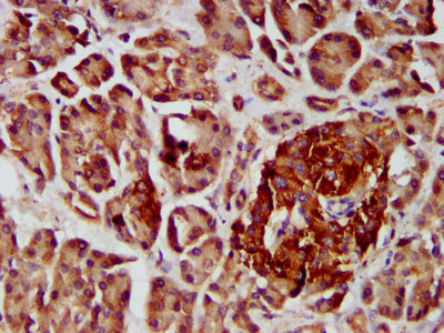 IHC image of the antibody diluted at 1:400 and staining in paraffin-embedded human pancreatic tissue performed on a Leica BondTM system. After dewaxing and hydration, antigen retrieval was mediated by high pressure in a citrate buffer (pH 6.0). Section was blocked with 10% normal goat serum 30min at RT. Then primary antibody (1% BSA) was incubated at 4°C overnight. The primary is detected by a biotinylated secondary antibody and visualized using an HRP conjugated SP system.Rabbit anti-Human COPG2 Polyclonal Antibody