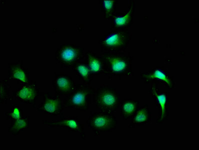 Immunofluorescence staining of A549 cells with CPNE7 Antibody at 1:100, counter-stained with DAPI. The cells were fixed in 4% formaldehyde, permeabilized using 0.2% Triton X-100 and blocked in 10% normal Goat Serum. The cells were then incubated with the antibody overnight at 4°C. The secondary antibody was Alexa Fluor 488-congugated AffiniPure Goat Anti-Rabbit IgG(H+L).Rabbit anti-Human CPNE7 Polyclonal Antibody