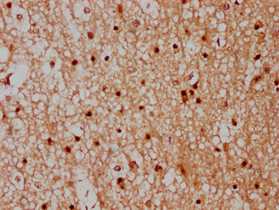 IHC image of CPNE7 Antibody diluted at 1:300 and staining in paraffin-embedded human brain tissue performed on a Leica BondTM system. After dewaxing and hydration, antigen retrieval was mediated by high pressure in a citrate buffer (pH 6.0). Section was blocked with 10% normal goat serum 30min at RT. Then primary antibody (1% BSA) was incubated at 4°C overnight. The primary is detected by a biotinylated secondary antibody and visualized using an HRP conjugated SP system.Rabbit anti-Human CPNE7 Polyclonal Antibody