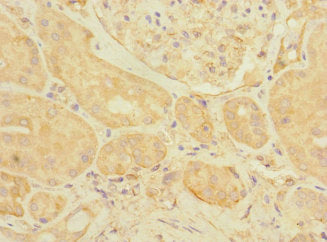 Immunohistochemistry of paraffin-embedded human kidney tissue using EIF3K Antibody at dilution of 1:100Rabbit anti-Human EIF3K Polyclonal Antibody