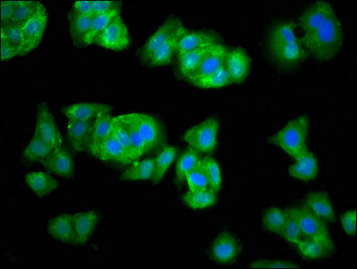Immunofluorescence staining of HepG2 cells with SEL1L Antibody at 1:33, counter-stained with DAPI. The cells were fixed in 4% formaldehyde, permeabilized using 0.2% Triton X-100 and blocked in 10% normal Goat Serum. The cells were then incubated with the antibody overnight at 4°C. The secondary antibody was Alexa Fluor 488-congugated AffiniPure Goat Anti-Rabbit IgG(H+L).