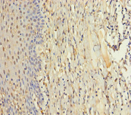 Immunohistochemistry of paraffin-embedded human tonsil tissue using ZMAT5 Antibody at dilution of 1:100Rabbit anti-Human ZMAT5 Polyclonal Antibody