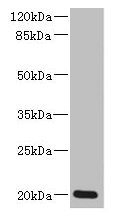 Western blot  | All lanes: ZMAT5 antibody at 5µg/ml + Colo320 whole cell lysate  | Secondary  | Goat polyclonal to rabbit IgG at 1/10000 dilution  | Predicted band size: 20 kDa  | Observed band size: 20 kDaRabbit anti-Human ZMAT5 Polyclonal Antibody