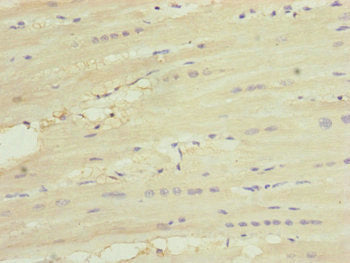 Immunohistochemistry of paraffin-embedded human heart tissue using UQCC2 Antibody at dilution of 1:100Rabbit anti-Human UQCC2 Polyclonal Antibody