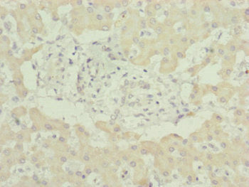 Immunohistochemistry of paraffin-embedded human liver tissue using UQCC2 Antibody at dilution of 1:100Rabbit anti-Human UQCC2 Polyclonal Antibody