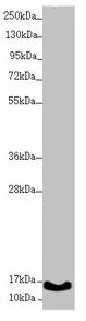 Western blot  | All lanes: UQCC2 antibody at 1.74µg/ml + A431 whole cell lysate  | Secondary  | Goat polyclonal to rabbit IgG at 1/10000 dilution  | Predicted band size: 15 kDa  | Observed band size: 15 kDaRabbit anti-Human UQCC2 Polyclonal Antibody