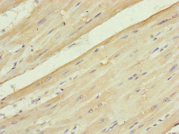 Immunohistochemistry of paraffin-embedded human heart tissue using UQCC2 Antibody at dilution of 1:100Rabbit anti-Human UQCC2 Polyclonal Antibody