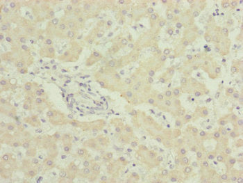 Immunohistochemistry of paraffin-embedded human liver tissue using UQCC2 Antibody at dilution of 1:100Rabbit anti-Human UQCC2 Polyclonal Antibody