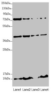 Western blot | All lanes: UQCC2 antibody at 3.35 μg/ml | Lane 1: HepG2 whole cell lysate | Lane 2: 293T whole cell lysate | Lane 3: Jurkat whole cell lysate | Lane 4: A431 whole cell lysate | Secondary | Goat polyclonal to rabbit IgG at 1/10000 dilution | Predicted band size: 15 kDa | Observed band size: 15, 40, 80 kDaRabbit anti-Human UQCC2 Polyclonal Antibody