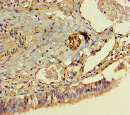 Immunohistochemistry of paraffin-embedded human lung tissue using DPH7 Antibody at dilution of 1:100Rabbit anti-Human DPH7 Polyclonal Antibody