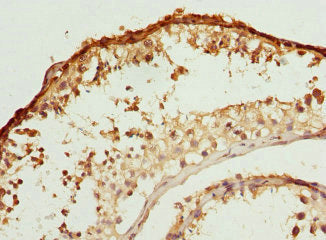 Immunohistochemistry of paraffin-embedded human testis tissue using BBS2 Antibody at dilution of 1:100
