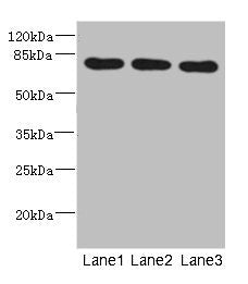 Western blot | All lanes: BBS2 antibody at 5.01μg/ml | Lane 1: Mouse liver tissue | Lane 2: Mouse brain tissue | Lane 3: Mouse gonadal tissue | Secondary | Goat polyclonal to rabbit IgG at 1/10000 dilution | Predicted band size: 80 kDa | Observed band size: 80 kDa