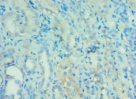 Immunohistochemistry of paraffin-embedded human kidney tissue using ANGPTL4 Antibody at dilution of 1:100Rabbit anti-Human ANGPTL4 Polyclonal Antibody