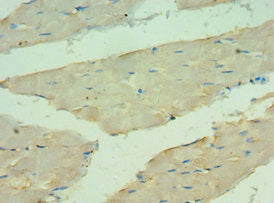 Immunohistochemistry of paraffin-embedded human skeletal muscle tissue using ANGPTL4 Antibody at dilution of 1:100Rabbit anti-Human ANGPTL4 Polyclonal Antibody