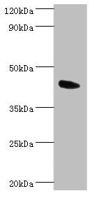 Western blot | All lanes: Angiopoietin-related protein 4 antibody at 2μg/ml + Mouse heart tissue | Secondary | Goat polyclonal to rabbit IgG at 1/10000 dilution | Predicted band size: 46, 41, 27 kDa | Observed band size: 46 kDaRabbit anti-Human ANGPTL4 Polyclonal Antibody