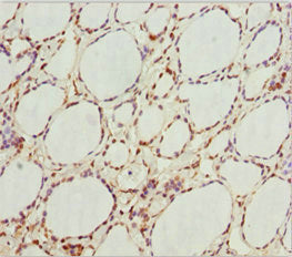 Immunohistochemistry of paraffin-embedded human thyroid tissue using GNB1L Antibody at dilution of 1:100