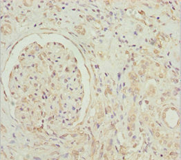 Immunohistochemistry of paraffin-embedded human kidney tissue using GNB1L Antibody at dilution of 1:100