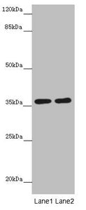 Western blot  | All lanes: GNB1L antibody at 3.69µg/ml  | Lane 1: Mouse brain tissue  | Lane 2: Jurkat whole cell lysate  | Secondary  | Goat polyclonal to rabbit IgG at 1/10000 dilution  | Predicted band size: 36, 23 kDa  | Observed band size: 36 kDa
