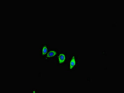 Immunofluorescent analysis of HepG2 cells using ACE2 Antibody at dilution of 1:100 and Alexa Fluor 488-congugated AffiniPure Goat Anti-Rabbit IgG(H+L)