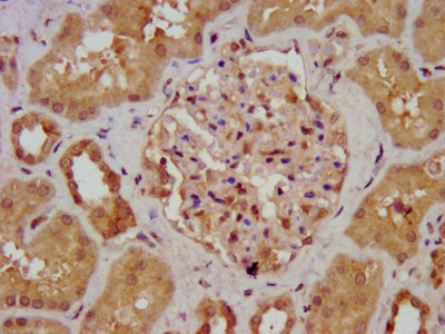 IHC image of AGXT2 Antibody diluted at 1:700 and staining in paraffin-embedded human kidney tissue performed on a Leica BondTM system. After dewaxing and hydration, antigen retrieval was mediated by high pressure in a citrate buffer (pH 6.0). Section was blocked with 10% normal goat serum 30min at RT. Then primary antibody (1% BSA) was incubated at 4°C overnight. The primary is detected by a biotinylated secondary antibody and visualized using an HRP conjugated SP system.Rabbit anti-Human AGXT2 Polyclonal Antibody