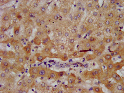 IHC image of AGXT2 Antibody diluted at 1:700 and staining in paraffin-embedded human liver tissue performed on a Leica BondTM system. After dewaxing and hydration, antigen retrieval was mediated by high pressure in a citrate buffer (pH 6.0). Section was blocked with 10% normal goat serum 30min at RT. Then primary antibody (1% BSA) was incubated at 4°C overnight. The primary is detected by a biotinylated secondary antibody and visualized using an HRP conjugated SP system.Rabbit anti-Human AGXT2 Polyclonal Antibody