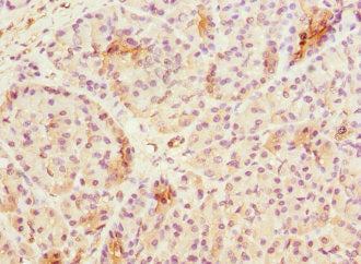Immunohistochemistry of paraffin-embedded human pancreatic tissue using ASPSCR1 Antibody at dilution of 1:100Rabbit anti-Human ASPSCR1 Polyclonal Antibody