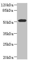 Western blot | All lanes: ASPSCR1 antibody at 8.71μg/ml + 293T whole cell lysate | Secondary | Goat polyclonal to rabbit IgG at 1/10000 dilution | Predicted band size: 61, 70, 55, 38 kDa | Observed band size: 61 kDaRabbit anti-Human ASPSCR1 Polyclonal Antibody