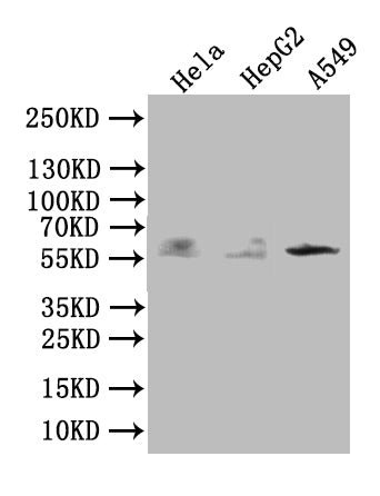 Western Blot Positive WB detected in: Hela whole cell lysate, HepG2 whole cell lysate, A549 whole cell lysate All lanes: TRIM4 antibody at 1:1000 Secondary Goat polyclonal to rabbit IgG at 1/50000 dilution Predicted band size: 58 kDa Observed band size: 58 kDaRabbit anti-Human TRIM4 Polyclonal Antibody