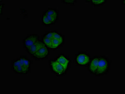 Immunofluorescent analysis of MCF-7 cells using DRAM2 Antibody at dilution of 1:100 and Alexa Fluor 488-congugated AffiniPure Goat Anti-Rabbit IgG(H+L)Rabbit anti-Human DRAM2 Polyclonal Antibody