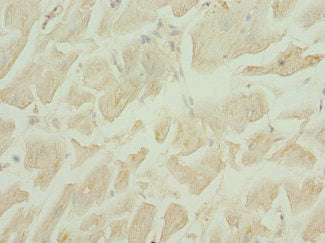 Immunohistochemistry of paraffin-embedded human heart tissue using DRAM2 Antibody at dilution of 1:100Rabbit anti-Human DRAM2 Polyclonal Antibody