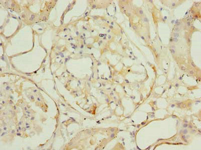Immunohistochemistry of paraffin-embedded human kidney tissue using ROGDI Antibody at dilution of 1:100Rabbit anti-Human ROGDI Polyclonal Antibody