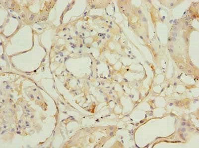 Immunohistochemistry of paraffin-embedded human kidney tissue using ROGDI Antibody at dilution of 1:100Rabbit anti-Human ROGDI Polyclonal Antibody